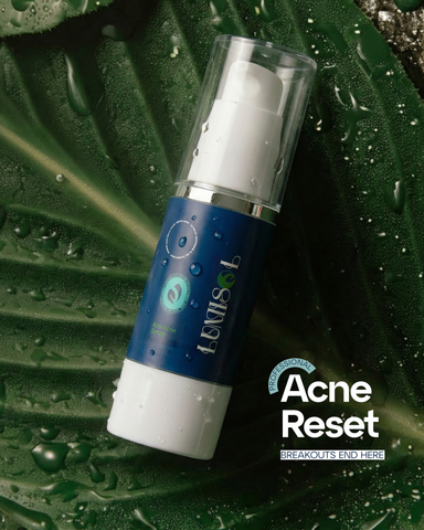 Solana Lumisol Acne Serum 30ml